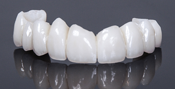 Oral-Temp<sup>®</sup> Restorations 