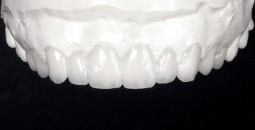 Diagnostic<br>Wax-Up